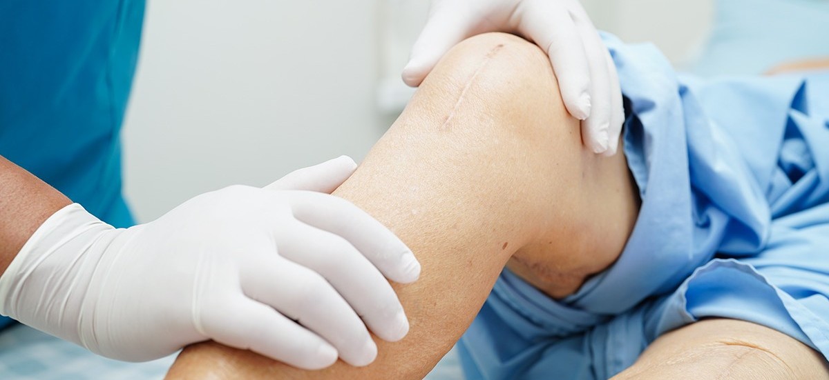 Joint Replacement Surgery Vijayawada