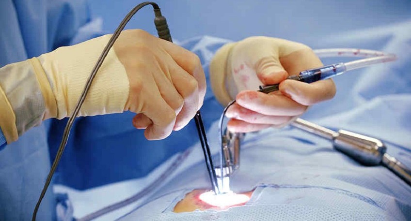 Spine Surgery Vijayawada